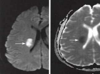 脑病科 特色优势诊疗技术219.png