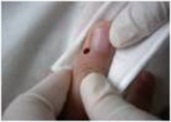 脑病科 特色优势诊疗技术543.png