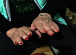 脑病科 特色优势诊疗技术544.png