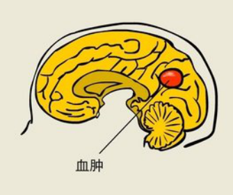 脑病科 特色优势诊疗技术889.png